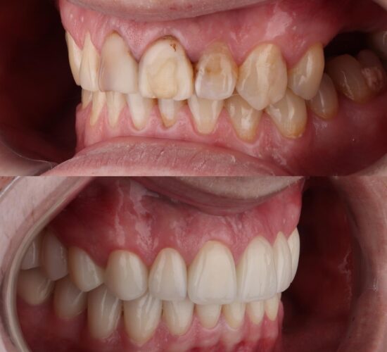Stomatološka ordinacija Beograd - IV Dental Studio