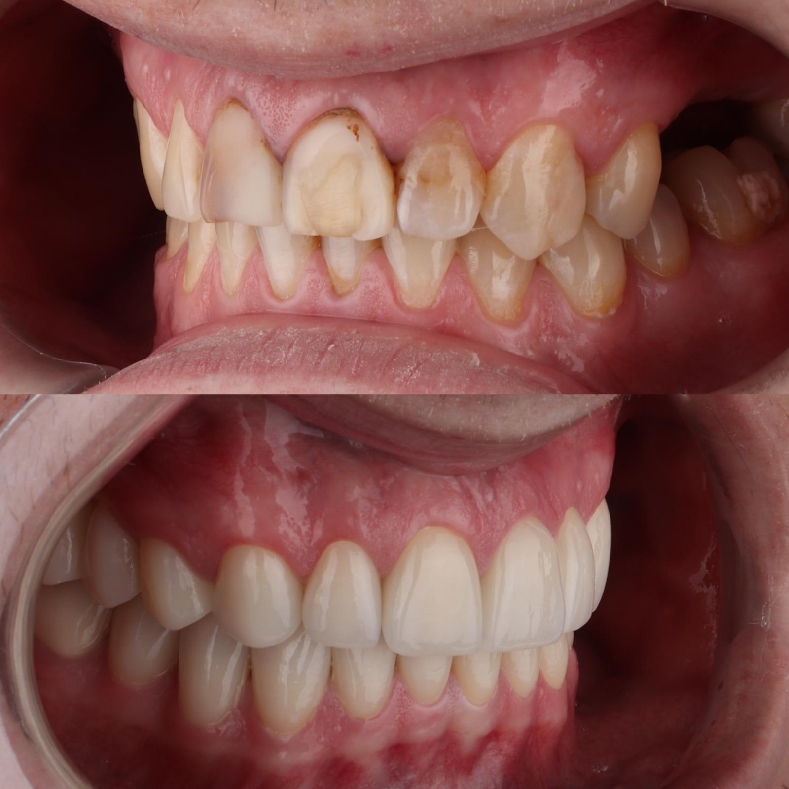 Stomatološka ordinacija Beograd - IV Dental Studio