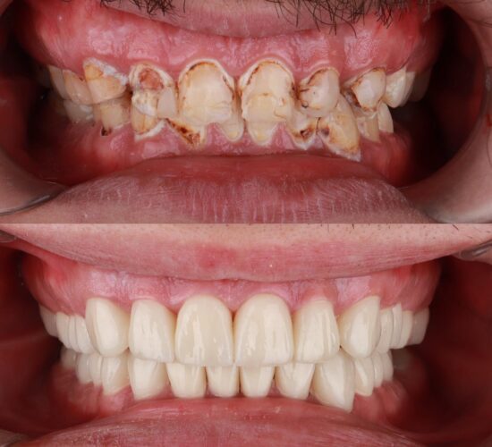 Stomatološka ordinacija Beograd - IV Dental Studio