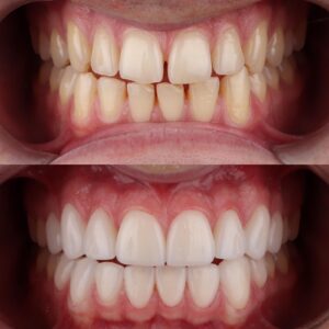 Stomatološka ordinacija Beograd - IV Dental Studio