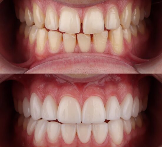 Stomatološka ordinacija Beograd - IV Dental Studio