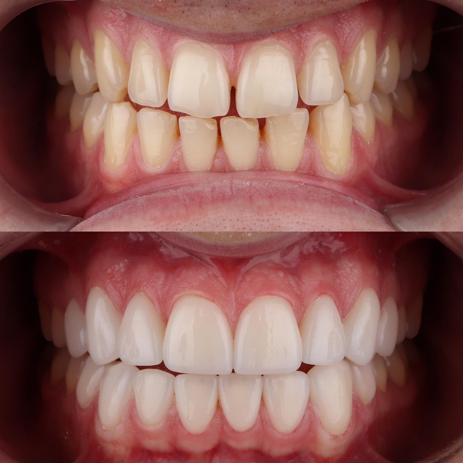 Stomatološka ordinacija Beograd - IV Dental Studio